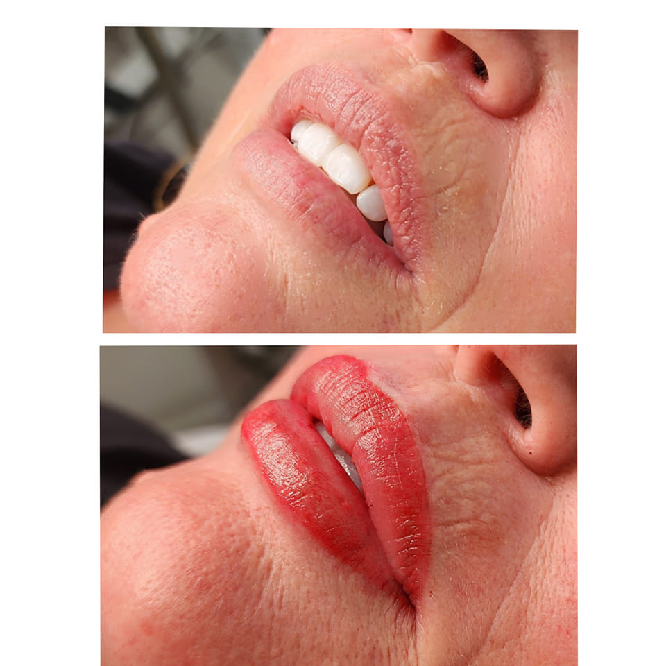 Permanent Lip Makeup Before and After